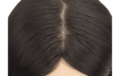 ¿Qué soluciones hay para alopecia de tipo difuso o androgenética femenina en posticería?
